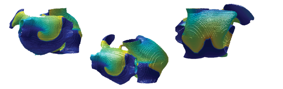 Atrial Tissue Modeling