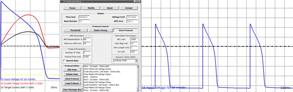 iPSC-CM Electrophysiology and Dynamic Clamp