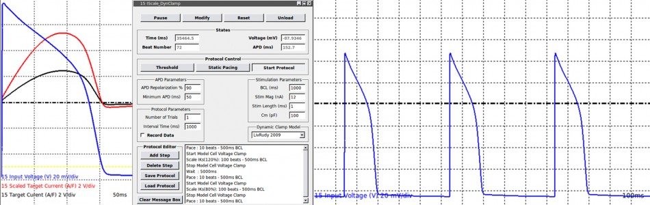 Cardiomyocyte Dynamic Clamp