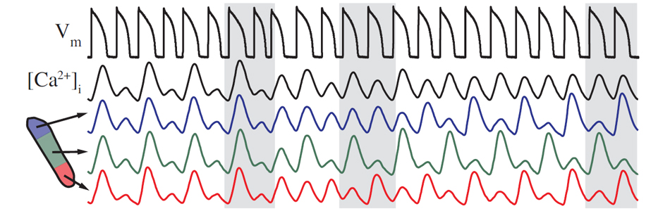 Electrophysiological Instabilities and Arrhythmia Onset